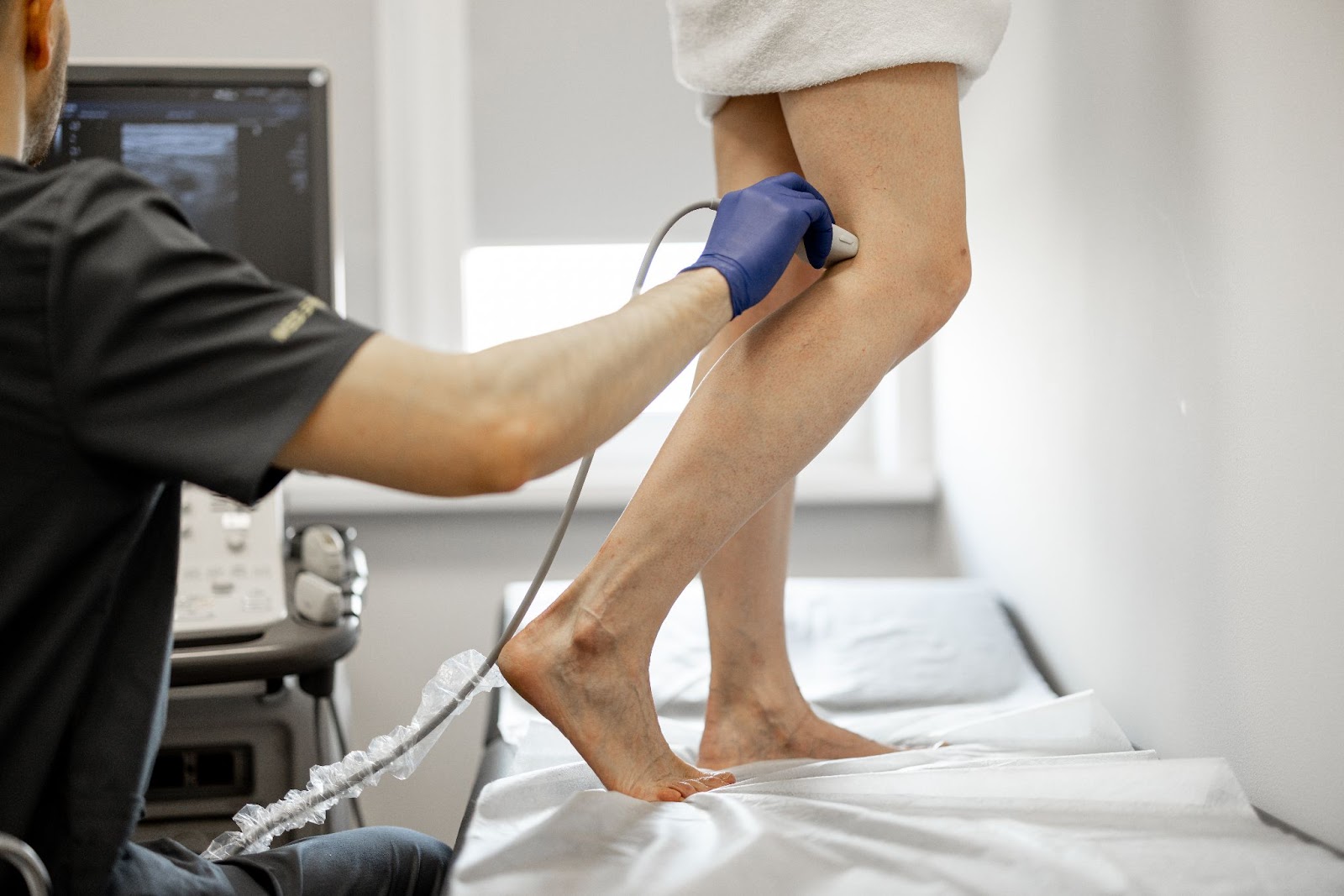 Diagnostika kŕčových žíl pomocou ultrazvuku.